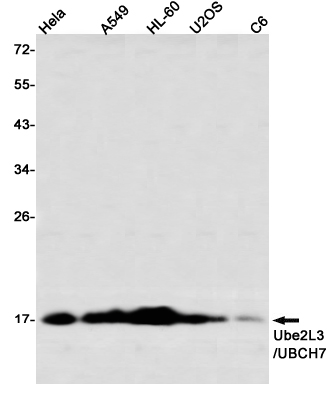 Ubiquitin Conjugating Enzyme E2 L3 Rabbit mAb